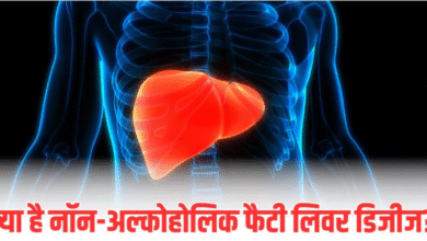 Photo of शराब नहीं पीते हैं? फिर भी हो सकता है Fatty Liver; जानें क्यों साइलेंट किलर बन रही ये बीमारी